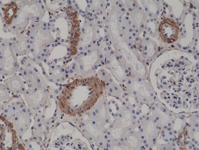 Alpha-Smooth Muscle Actin Antibody in Immunohistochemistry (Paraffin) (IHC (P))