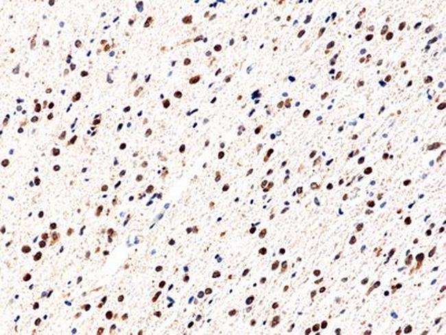 IDH1 (R132H) Antibody in Immunohistochemistry (Paraffin) (IHC (P))