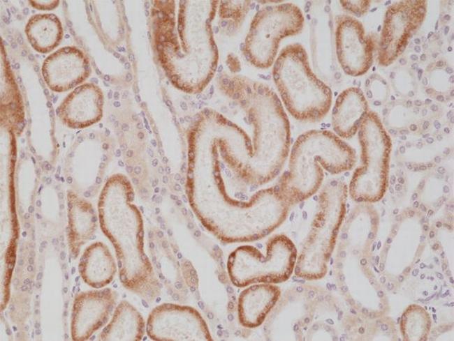 AMACR Antibody in Immunohistochemistry (Paraffin) (IHC (P))