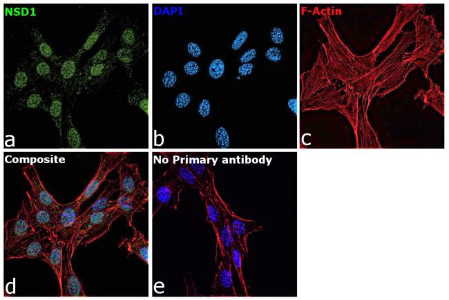 NSD1 Antibody in Immunocytochemistry (ICC/IF)