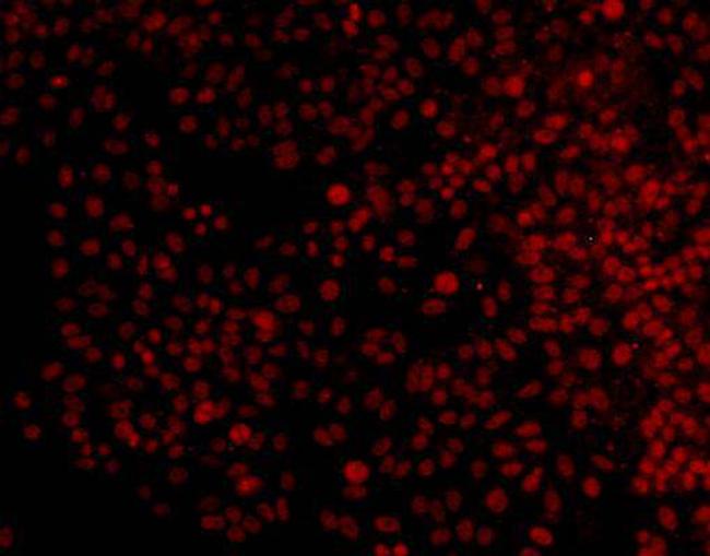 ERK1 Antibody in Immunocytochemistry (ICC/IF)