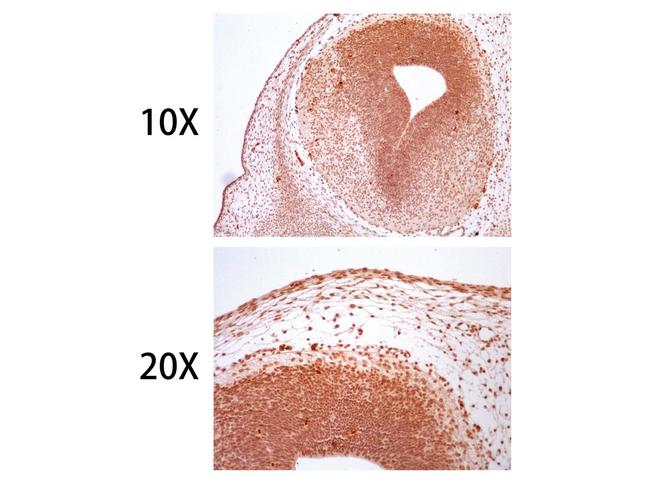 SOX10 Antibody in Immunohistochemistry (Paraffin) (IHC (P))