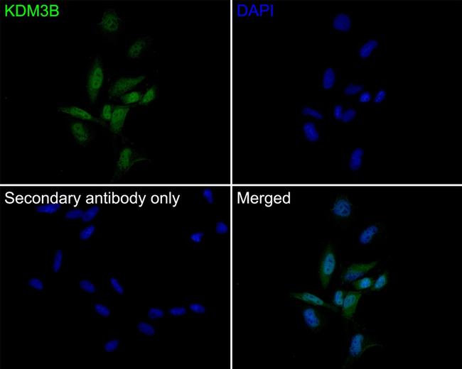 JMJD1B Antibody in Immunocytochemistry (ICC/IF)