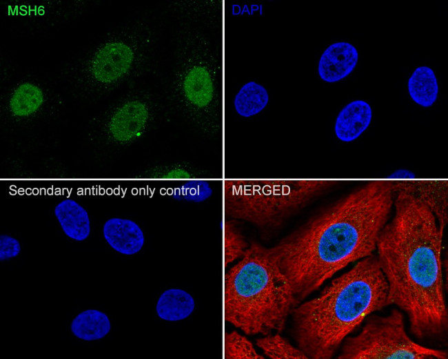 MSH6 Antibody in Immunocytochemistry (ICC/IF)