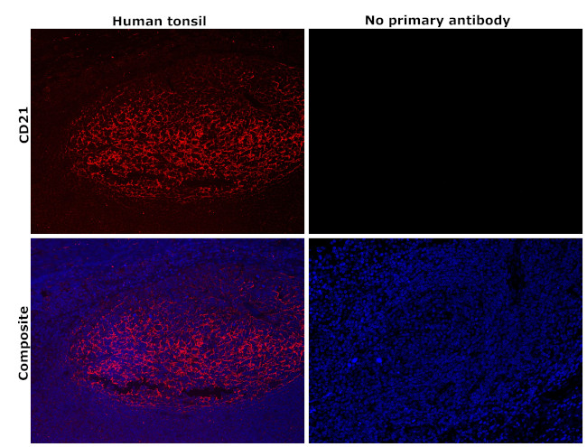 CD21 Antibody in Immunohistochemistry (Paraffin) (IHC (P))