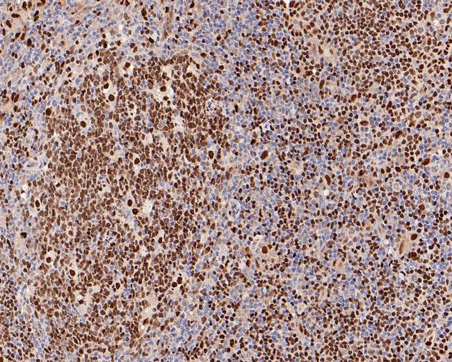 PU.1 Antibody in Immunohistochemistry (Paraffin) (IHC (P))