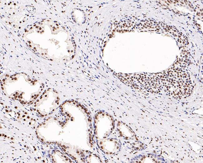 Androgen Receptor Antibody in Immunohistochemistry (Paraffin) (IHC (P))