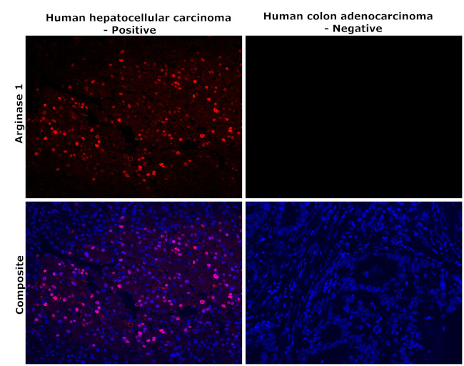 Arginase 1 Antibody in Immunohistochemistry (Paraffin) (IHC (P))