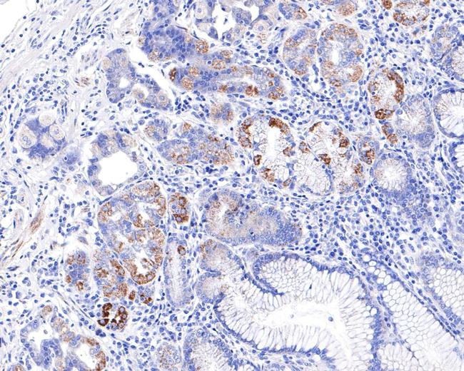 CECR5 Antibody in Immunohistochemistry (Paraffin) (IHC (P))