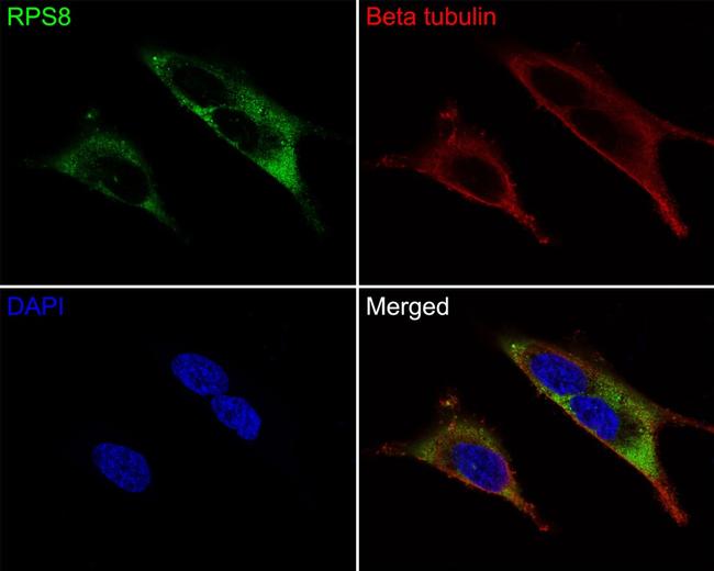 RPS8 Antibody in Immunocytochemistry (ICC/IF)