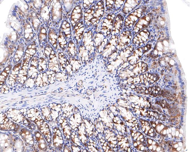 RASEF Antibody in Immunohistochemistry (Paraffin) (IHC (P))