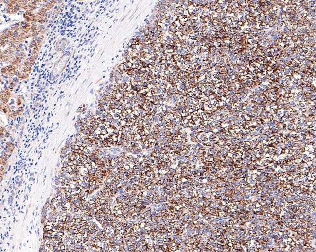 ACAT1 Antibody in Immunohistochemistry (Paraffin) (IHC (P))