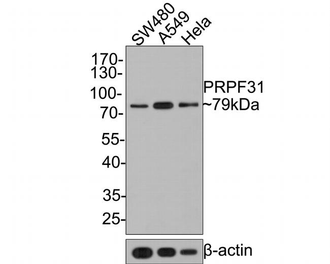 GNE Antibody in Western Blot (WB)