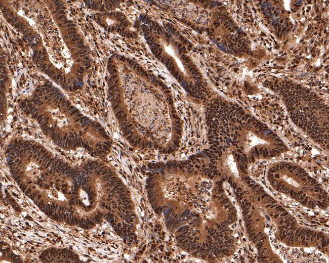 PRPF31 Antibody in Immunohistochemistry (Paraffin) (IHC (P))