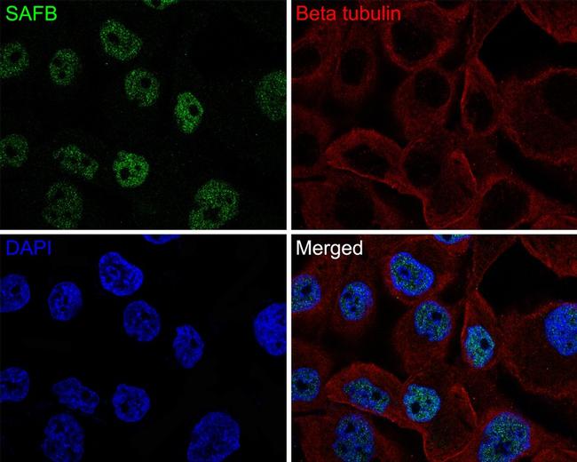 SAFB Antibody in Immunocytochemistry (ICC/IF)