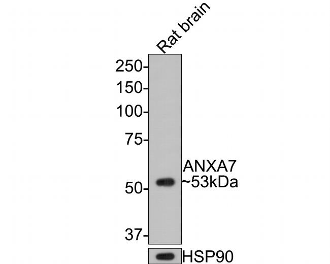 Annexin A7 Antibody in Western Blot (WB)