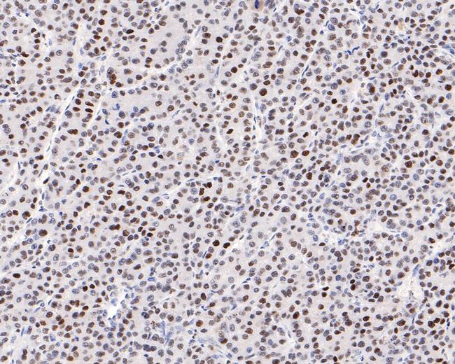 NUP50 Antibody in Immunohistochemistry (Paraffin) (IHC (P))