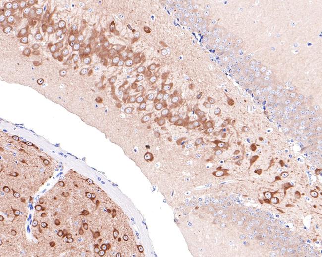 PREPL Antibody in Immunohistochemistry (Paraffin) (IHC (P))