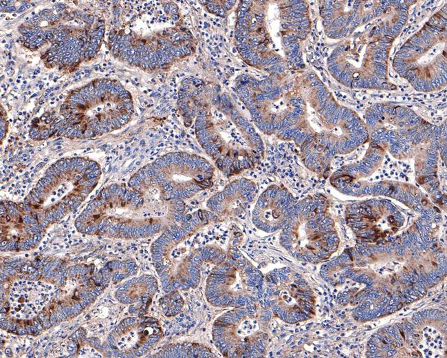 Annexin A7 Antibody in Immunohistochemistry (Paraffin) (IHC (P))