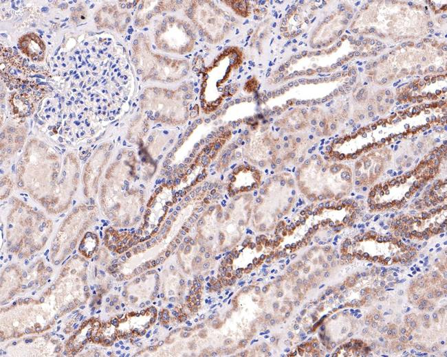 SLC25A12 Antibody in Immunohistochemistry (Paraffin) (IHC (P))