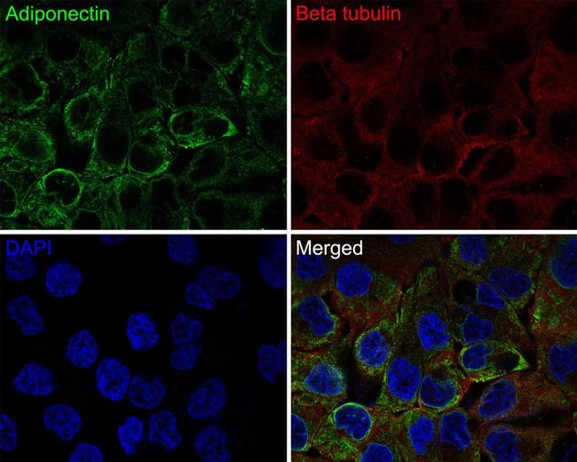 Adiponectin Antibody in Immunocytochemistry (ICC/IF)