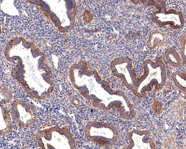 WDR1 Antibody in Immunohistochemistry (Paraffin) (IHC (P))