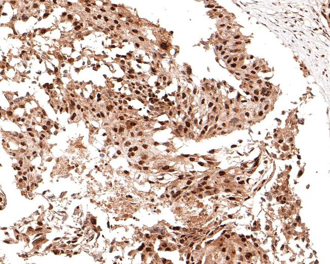 RSK2 Antibody in Immunohistochemistry (Paraffin) (IHC (P))