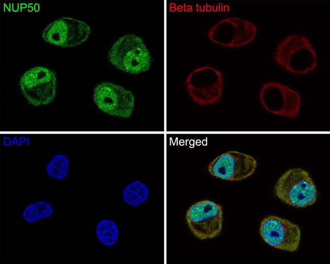 NUP50 Antibody in Immunocytochemistry (ICC/IF)