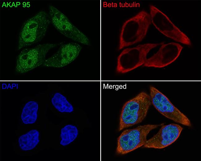 AKAP8 Antibody in Immunocytochemistry (ICC/IF)