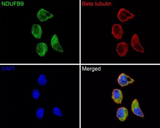 NDUFB9 Antibody in Immunocytochemistry (ICC/IF)