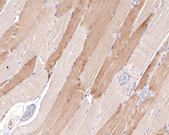 ATG4A Antibody in Immunohistochemistry (Paraffin) (IHC (P))