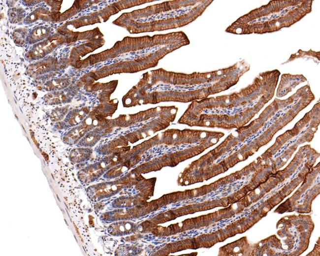 GNA13 Antibody in Immunohistochemistry (Paraffin) (IHC (P))