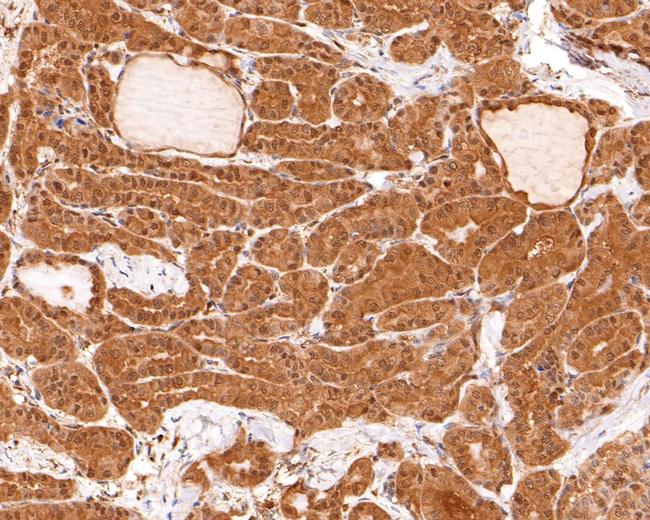 UBE2L3 Antibody in Immunohistochemistry (Paraffin) (IHC (P))