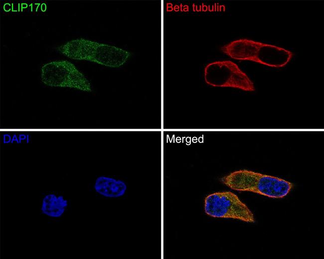 CLIP1 Antibody in Immunocytochemistry (ICC/IF)