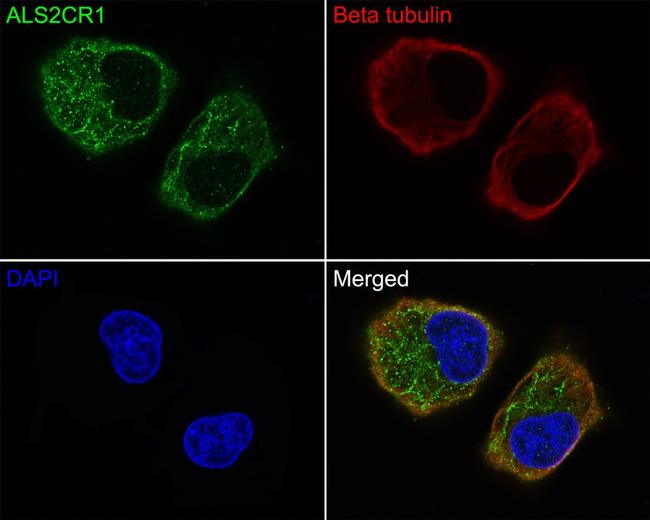 ALS2CR1 Antibody in Immunocytochemistry (ICC/IF)