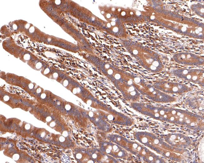 ALDH16A1 Antibody in Immunohistochemistry (Paraffin) (IHC (P))