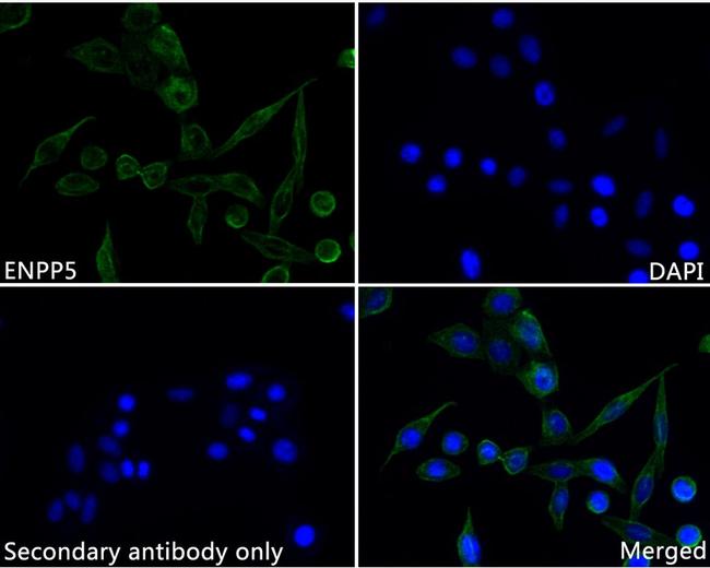 ENPP5 Antibody in Immunocytochemistry (ICC/IF)