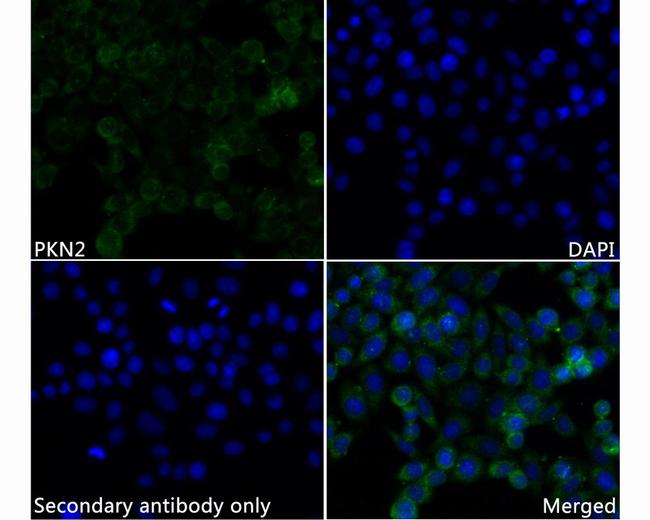 PKN2 Antibody in Immunocytochemistry (ICC/IF)