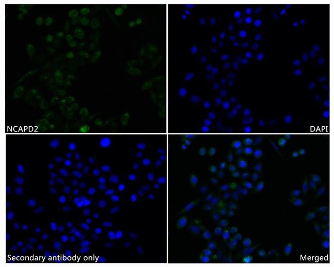 NCAPD2 Antibody in Immunocytochemistry (ICC/IF)