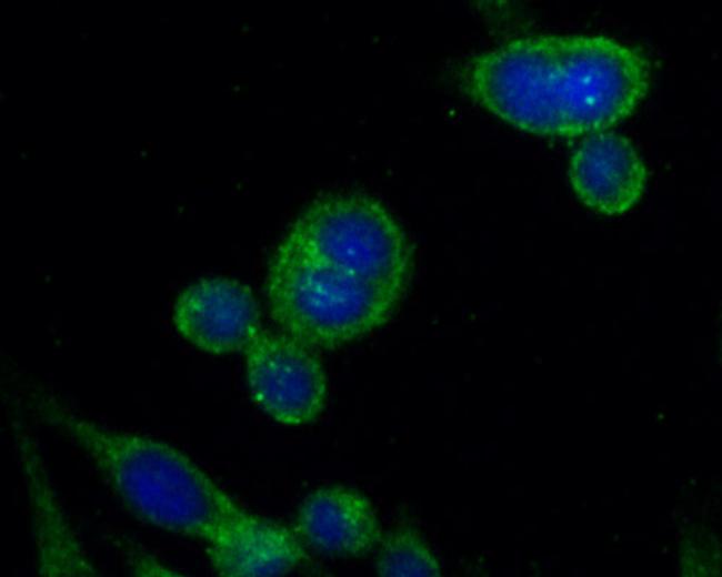 RPL13 Antibody in Immunocytochemistry (ICC/IF)