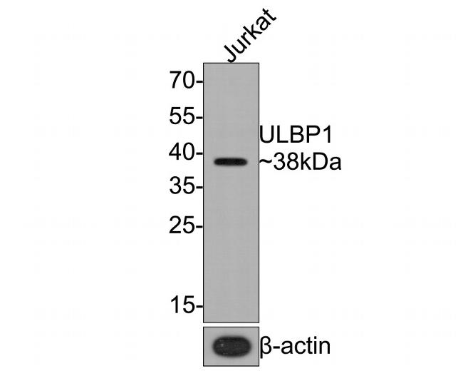 ULBP1 Antibody in Western Blot (WB)