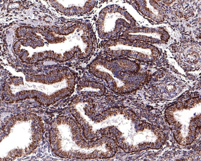 NDUFAB1 Antibody in Immunohistochemistry (Paraffin) (IHC (P))