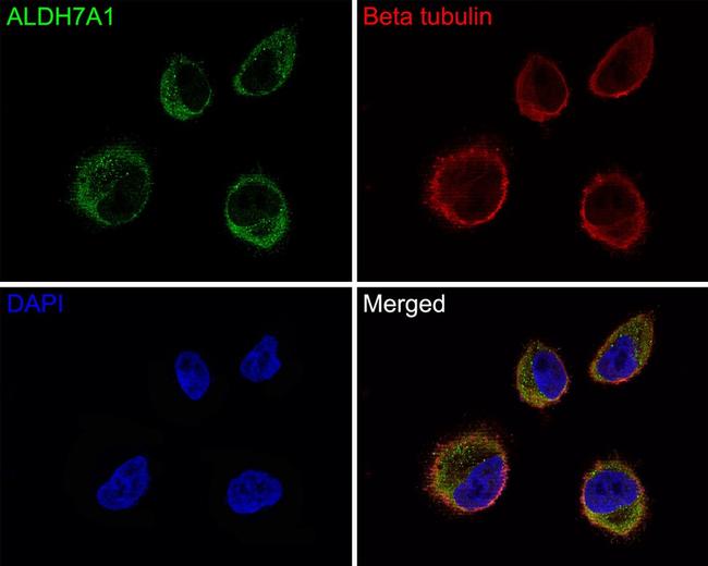 ALDH7A1 Antibody in Immunocytochemistry (ICC/IF)