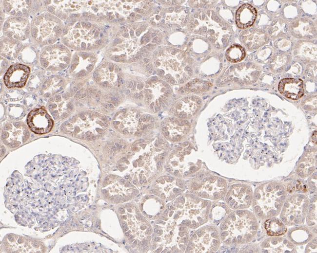 HMGCS2 Antibody in Immunohistochemistry (Paraffin) (IHC (P))