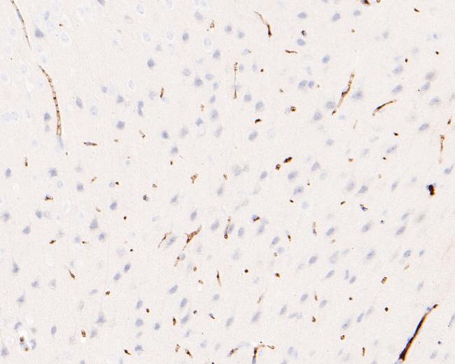 IRAK1 Antibody in Immunohistochemistry (Paraffin) (IHC (P))