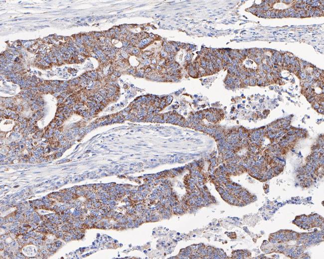 C1QBP Antibody in Immunohistochemistry (Paraffin) (IHC (P))