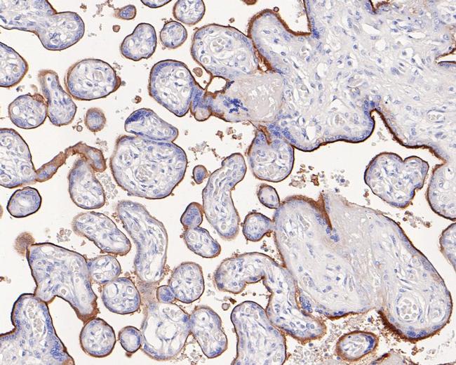 CD105 (Endoglin) Antibody in Immunohistochemistry (Paraffin) (IHC (P))