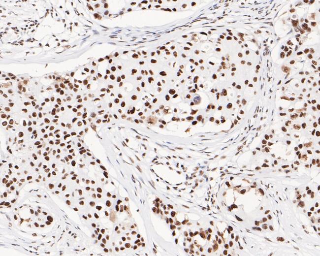 USP39 Antibody in Immunohistochemistry (Paraffin) (IHC (P))