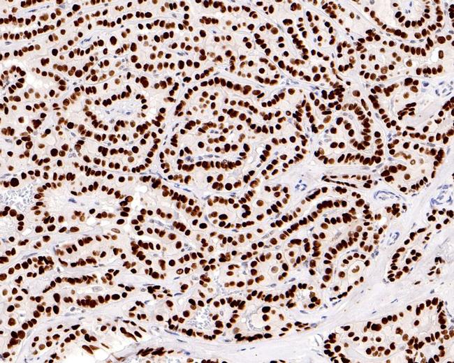 Nkx2.1 Antibody in Immunohistochemistry (Paraffin) (IHC (P))