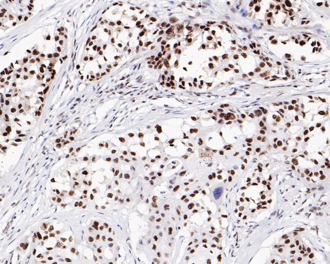 SR Antibody in Immunohistochemistry (Paraffin) (IHC (P))